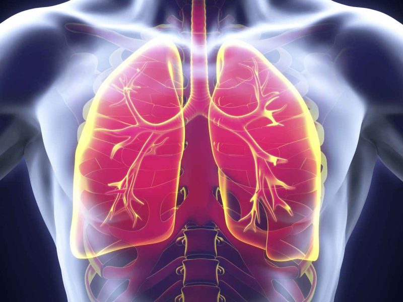 Double Pneumonia