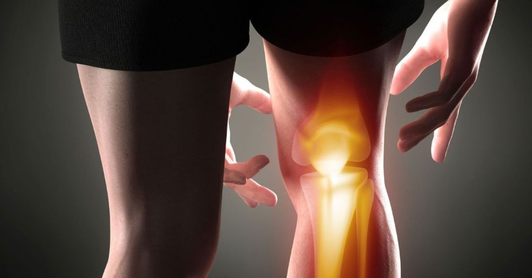 Arthritis