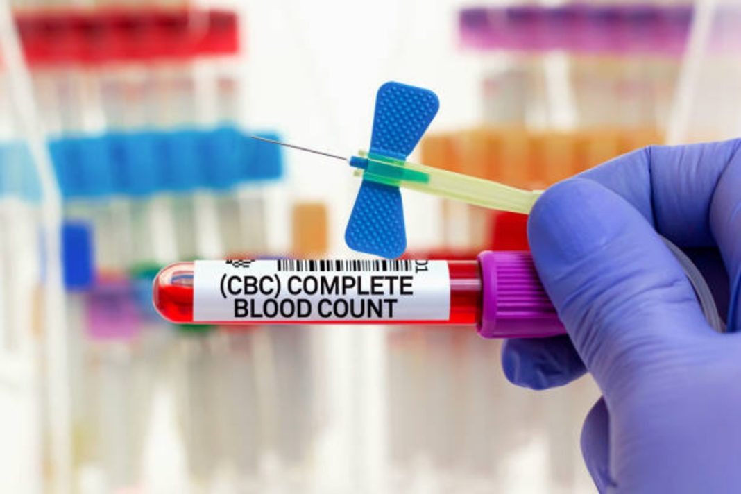 CBC Test Simplified